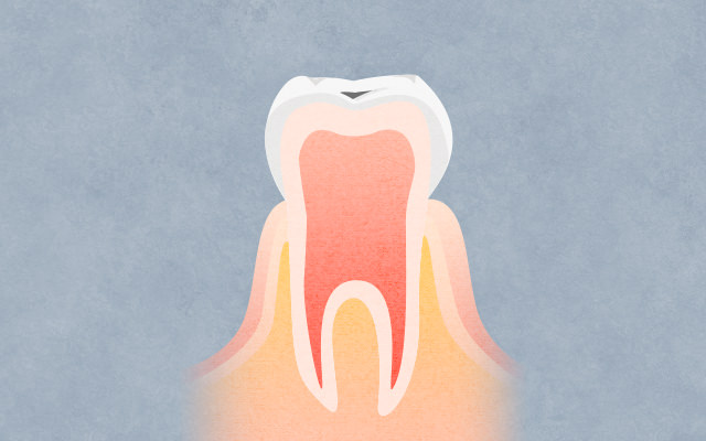 一般歯科 子供の虫歯やホワイトニングはぎふデンタルフォレスト